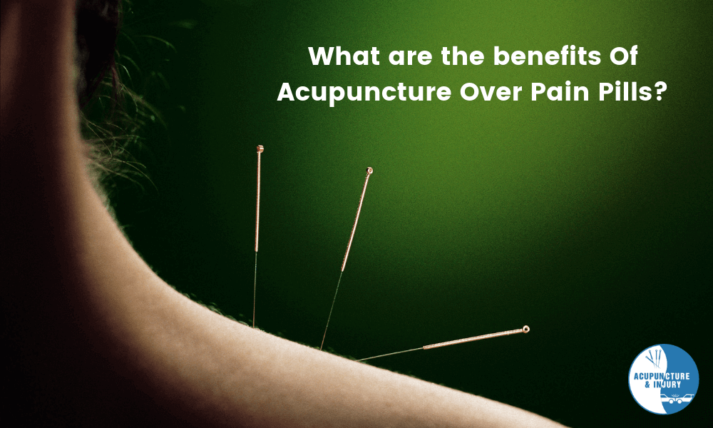 What Are The Benefits Of Acupuncture Over Pain Pills